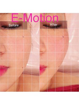 エモーション 横浜関内店(Emotion)/横浜フェイシャルエステ