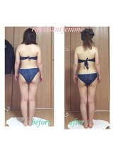 ラヴィソンファム(Ravissant femme)/痩身エステ/ビフォー&アフター