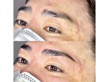 ボス ブロウ 天白店(BOSS BROW)/【メンズ眉毛】before after