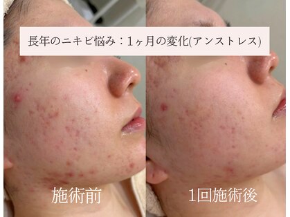 ラシュール(Rassure)の写真
