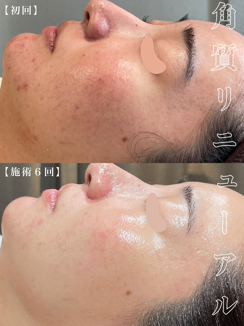 VOS サロンケア｜ゼアー(THERE FY.)｜ホットペッパービューティー