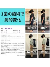 熊本カワル整体 JR上熊本駅院/1回の施術で劇的変化