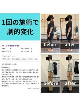 熊本カワル整体 JR上熊本駅院/1回の施術で劇的変化