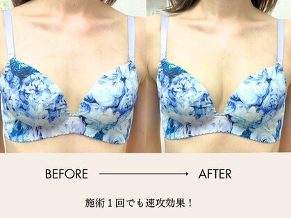 バーディー(BIRDIE)の写真