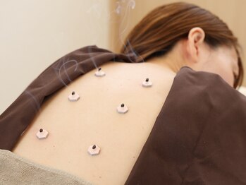 リターズ鍼灸治療所 天王寺院/お灸（冷え・痺れに効果あり◎）