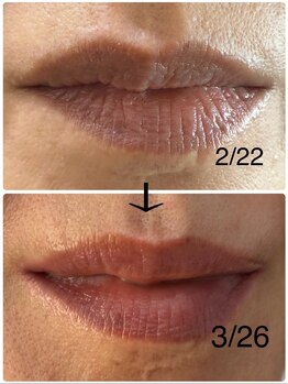 リュミエール デスポワール(Lumiere d'espoir)/ROMAPINK ローマピンク