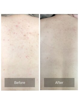 素肌研究所BSラボ/