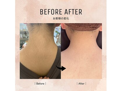 ルミエールブランシュ(Lumiere blanche)の写真