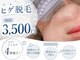 あおのアルパカの写真