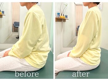 大川カイロプラクティックセンター 国立整体院/頭痛×猫背矯正 / BeforeAfter