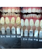 トウキョウスワーズ 池袋店(TOKYO SWRS)/#ホワイトニング #池袋 #渋谷