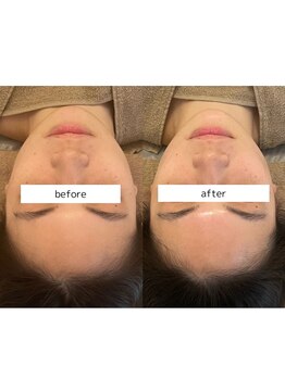 ソナ 大和西大寺院(SONA)/