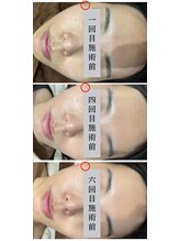 ナーススキン(nurse skin)/ビフォーアフター2