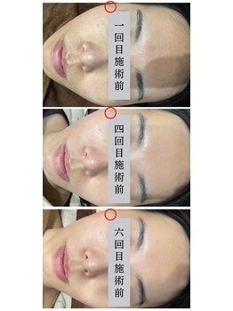 ナーススキン(nurse skin)/ビフォーアフター2