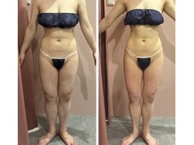 キュール(KuhL)/痩身ビフォーアフター☆