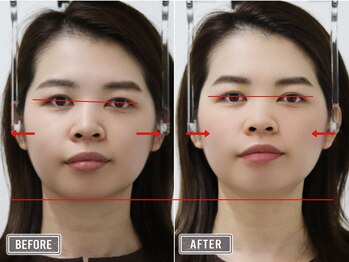 さつま骨格矯正 表参道青山院/歪み小顔矯正＋骨盤矯正