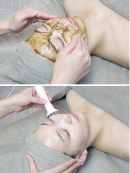 スリール 麻布十番(sourire)の写真/当店人気No.1★生プラセンタ＆剥離なしハーブピーリングの本格肌質改善トリートメント￥28,520→￥12,000