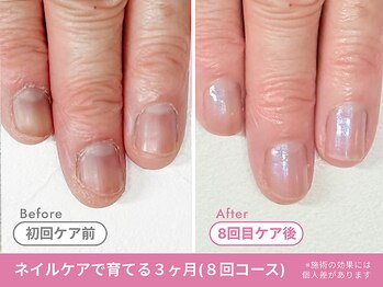 Before/After【feerie立川】