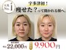 【小顔人気No.1】ほうれい線・たるみに｜韓国式リフトケア　22,000円→