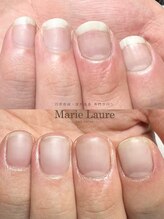 マリーロール 梅田店(Marie Laure)/自爪育成/深爪矯正/ネイルケア