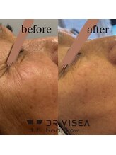 エクシア(Ecxia)/★ノアグロウ★