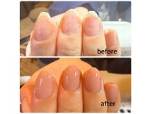 ミリアネイル 成城(Miliea nail)の雰囲気（割れ、欠けた爪でも施術法で艶玉フォルムへ♪）