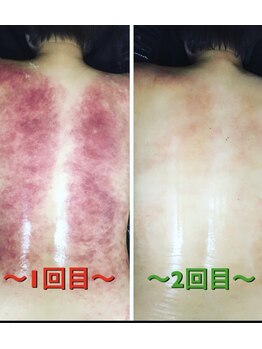 サロンリアンジュ ひたちなか店(Salon Liange)/体つまってる方はこうなります…