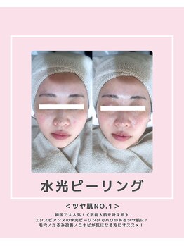 ソワナ(soina)/【神楽坂駅/フェイシャル/毛穴】