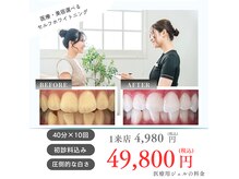 ホワイトニングショップ 霧島店の雰囲気（たくさんの笑顔と満足の声♪）