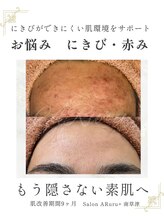 アルルプラス 南草津(ARuru+)/【肌改善】ビフォーアフター