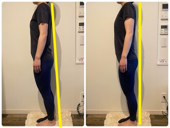 イオム ビューティワーク(IOM BEAUTY WORK)/前傾が真っ直ぐに!