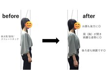 歴13年以上、9万人以上の施術の実績♪