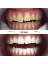 エクシアホワイト 平岸駅前店/