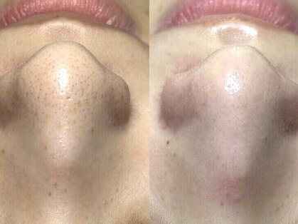 アース コアフュールボーテ 龍ヶ崎店(EARTH coiffure beaute)の写真