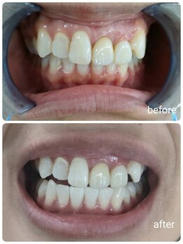 エクシアホワイト 福岡六本松/