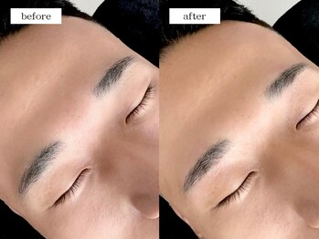 エムドット(m.)/メンズアイブロウワックス脱毛