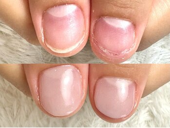 グレースレディ 大阪店/(深爪/長さだし/フィルイン)