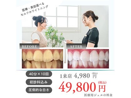 ホワイトニングショップ 霧島店の写真