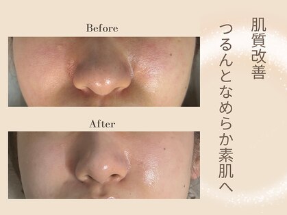 ピンナ(PINNA)の写真