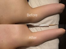 痩せにくい二の腕もスッキリ◎ブライダルメニューでもオススメ♪