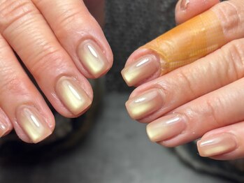 ユーネイ(unay)/フィルイン/マグネット/持ち込み