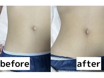 リフト 京都河原町(Lift)/小顔・痩身専門店Lift｜痩身施術