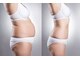 リラ(Lilas)の写真/《5月末まで限定5名》脱おば体型へ！たるみ卒業全身痩身120分