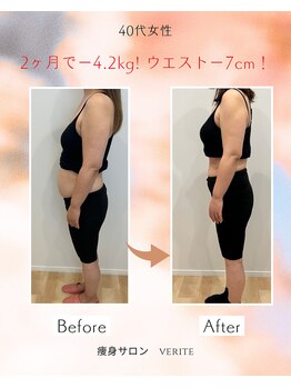 ヴェリテ(Verite)/before after 40代