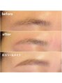 ネイルアンドアイ ビューティーオーブ(nail&eye beauty ORB)&nbsp;アイブロウWax脱毛