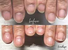 ツメハピ(tumehapi)/甘皮ケアビフォーアフター