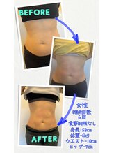 やお駅前鍼灸接骨院/電磁パルス痩身マシン