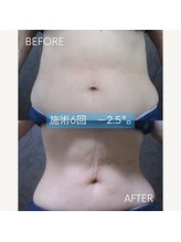 ヴィオテラス(VIOTERACE)/上半身ダイエット☆★