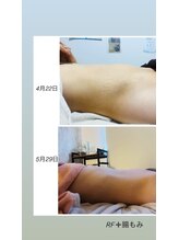 ナチュラルビューティラテ(NATURAL BEAUTY LATTE)/腸もみ