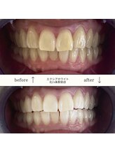 エクシアホワイト 平岸駅前店/